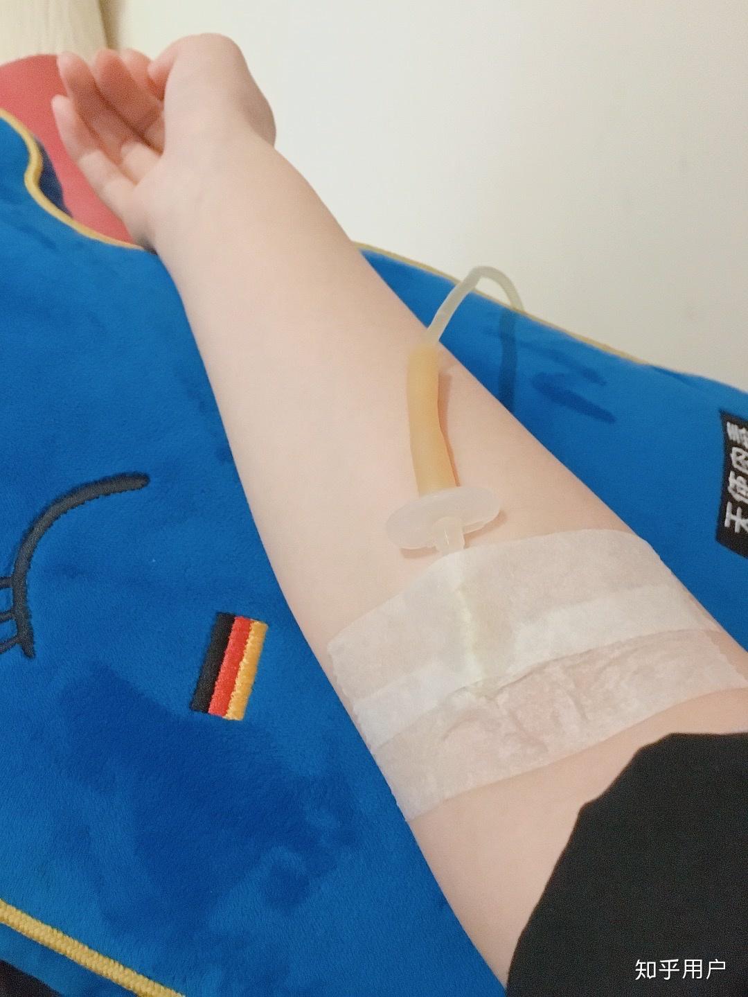 打美白针一般多少钱