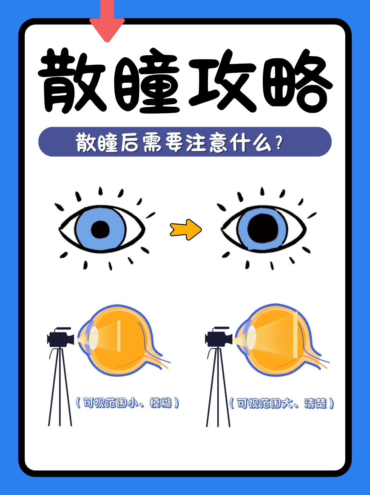 近视矫正术前检查为什么要散瞳 - 知乎