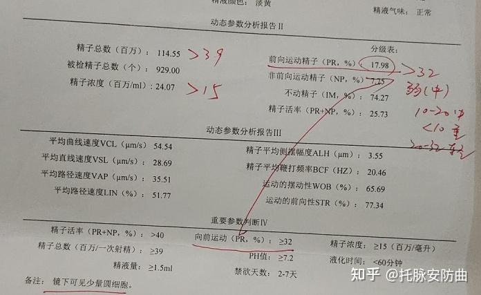 精索静脉曲张显微镜微创结扎手术经历分享