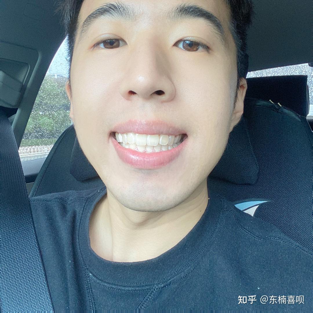 男生牙齿也是需要矫正滴