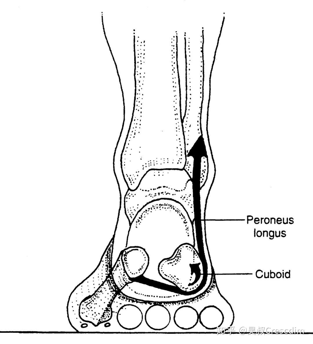 长跑步以后脚踝外侧偏下靠近脚板的位置疼求解惑什么地方出了问题