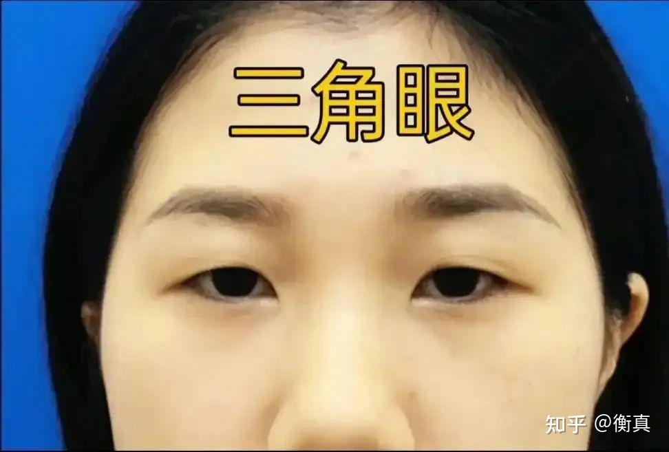 “小心眼”面相：遇到这类人，言行皆需多注意，那些明星需要值得我们注意? - 知乎