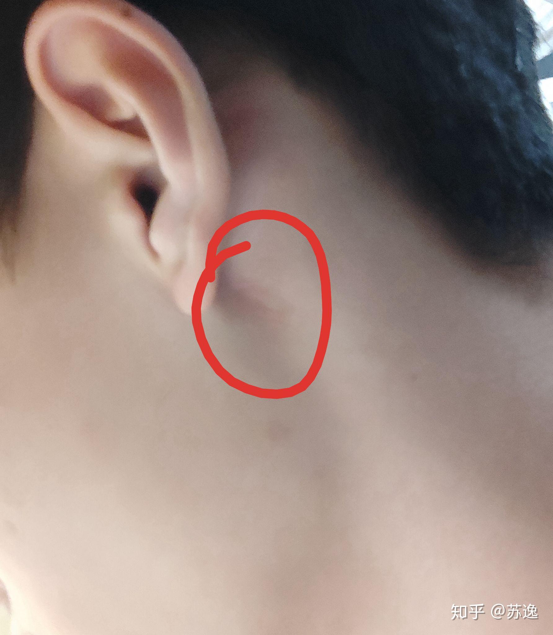 耳朵后面,一阵一阵疼痛,十六分钟痛了35次,是什么原因? - 知乎