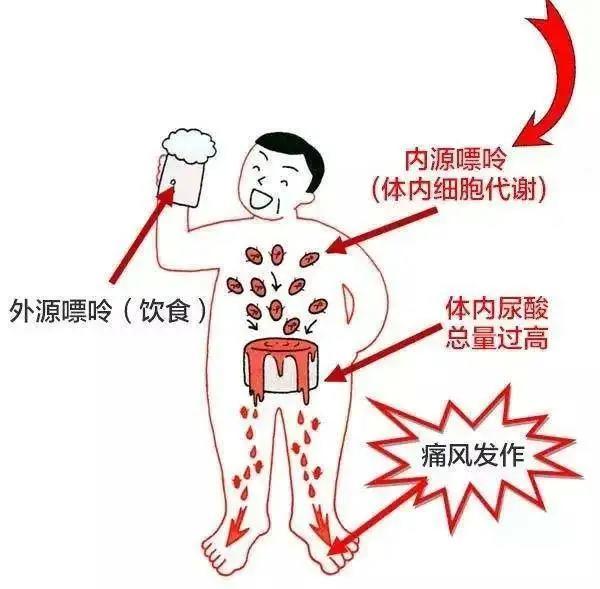 年轻人患上痛风的根本原因是什么