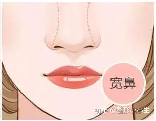 v2-f1d3dea339f87f5a7e3952d3f2d37278_b.jpg