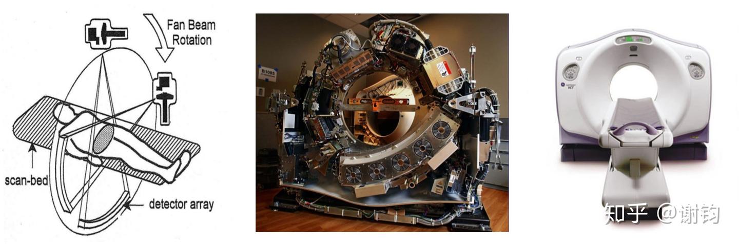 现代医学成像(3)——CT(基本原理与图像重建) - 知乎