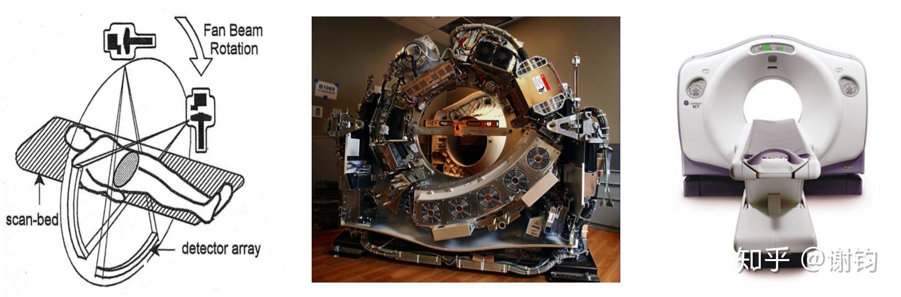 现代医学成像（3）——CT（基本原理与图像重建） - 知乎