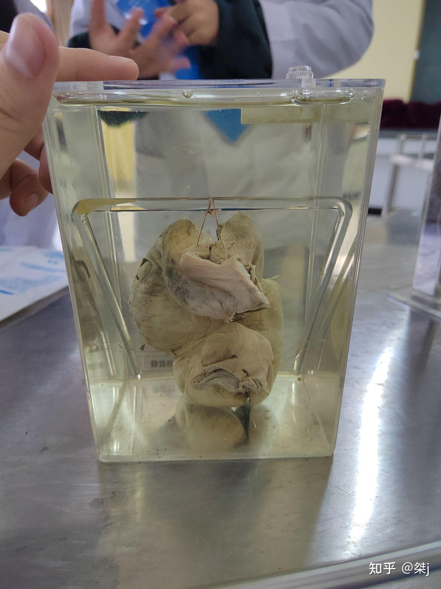 病理学器官切片