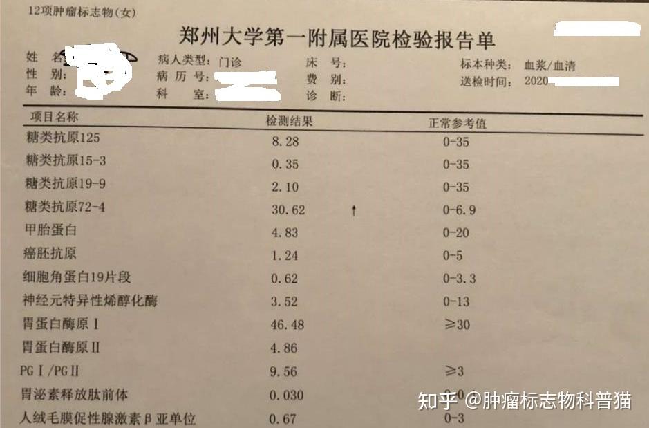 糖类抗原ca724偏高图片