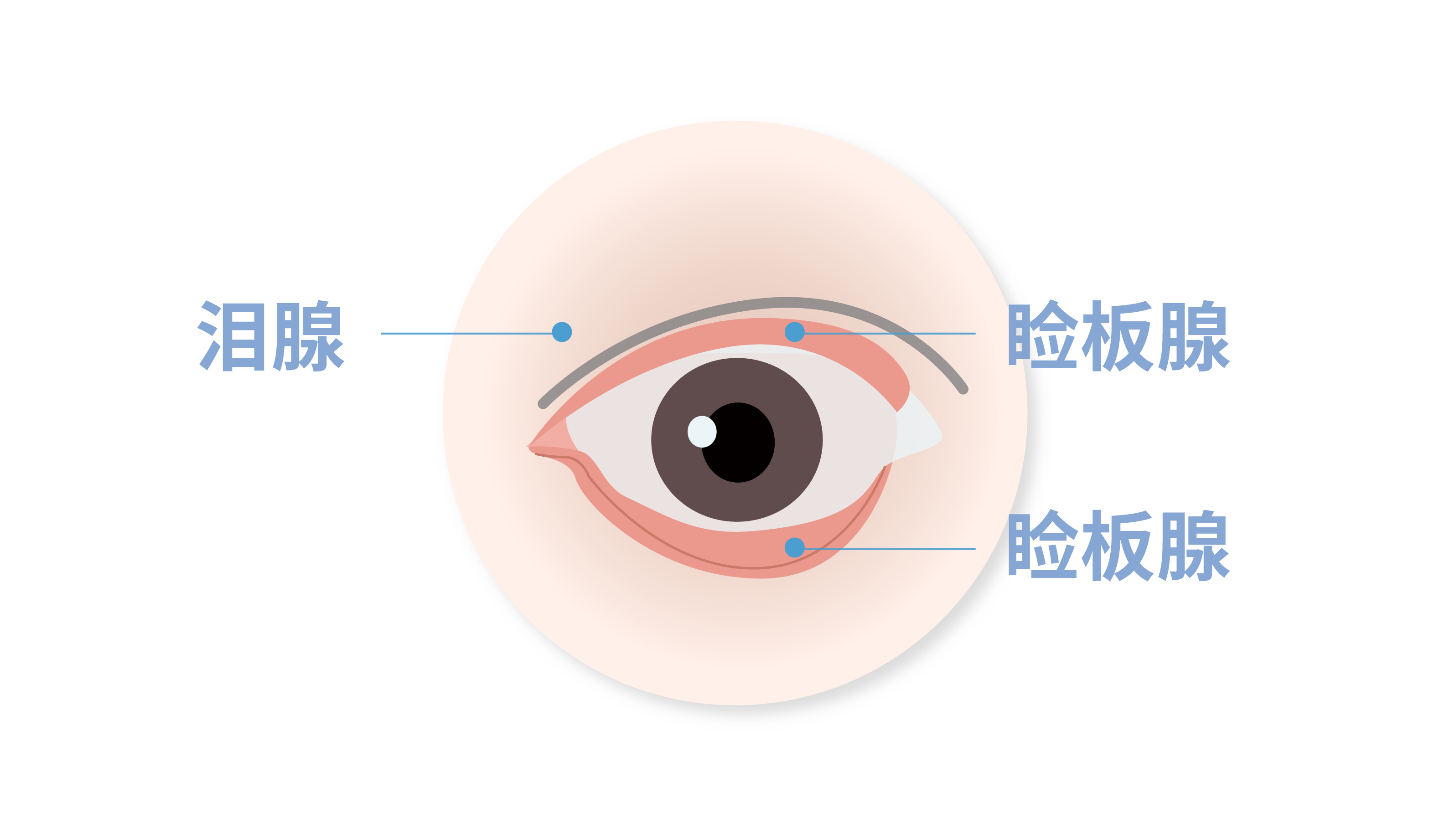 为什么大多数干眼症都是由睑板腺功能障碍引起？ - 知乎