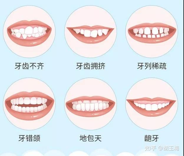 完美笑线丨你不知道的关于笑容的秘密 - 知乎