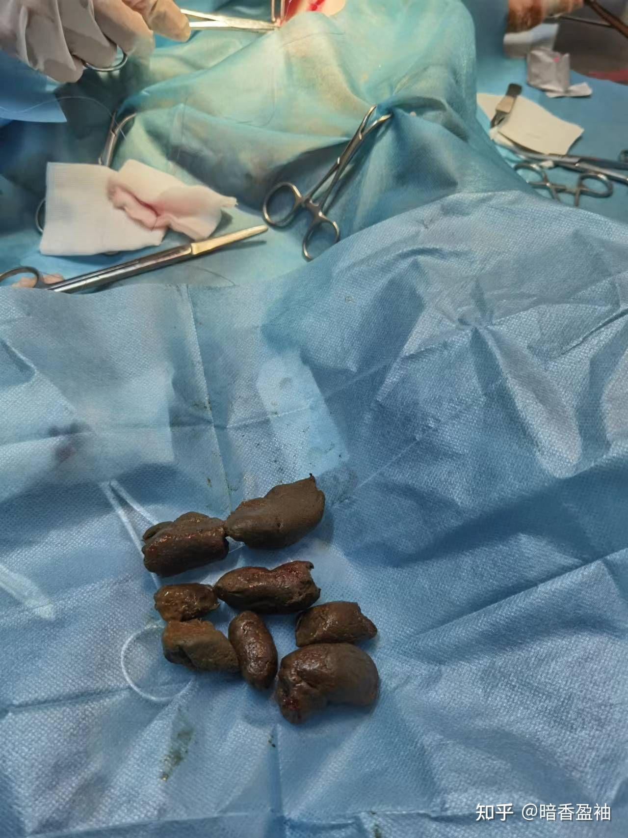 我家大橘猫的抗肠梗阻的经历