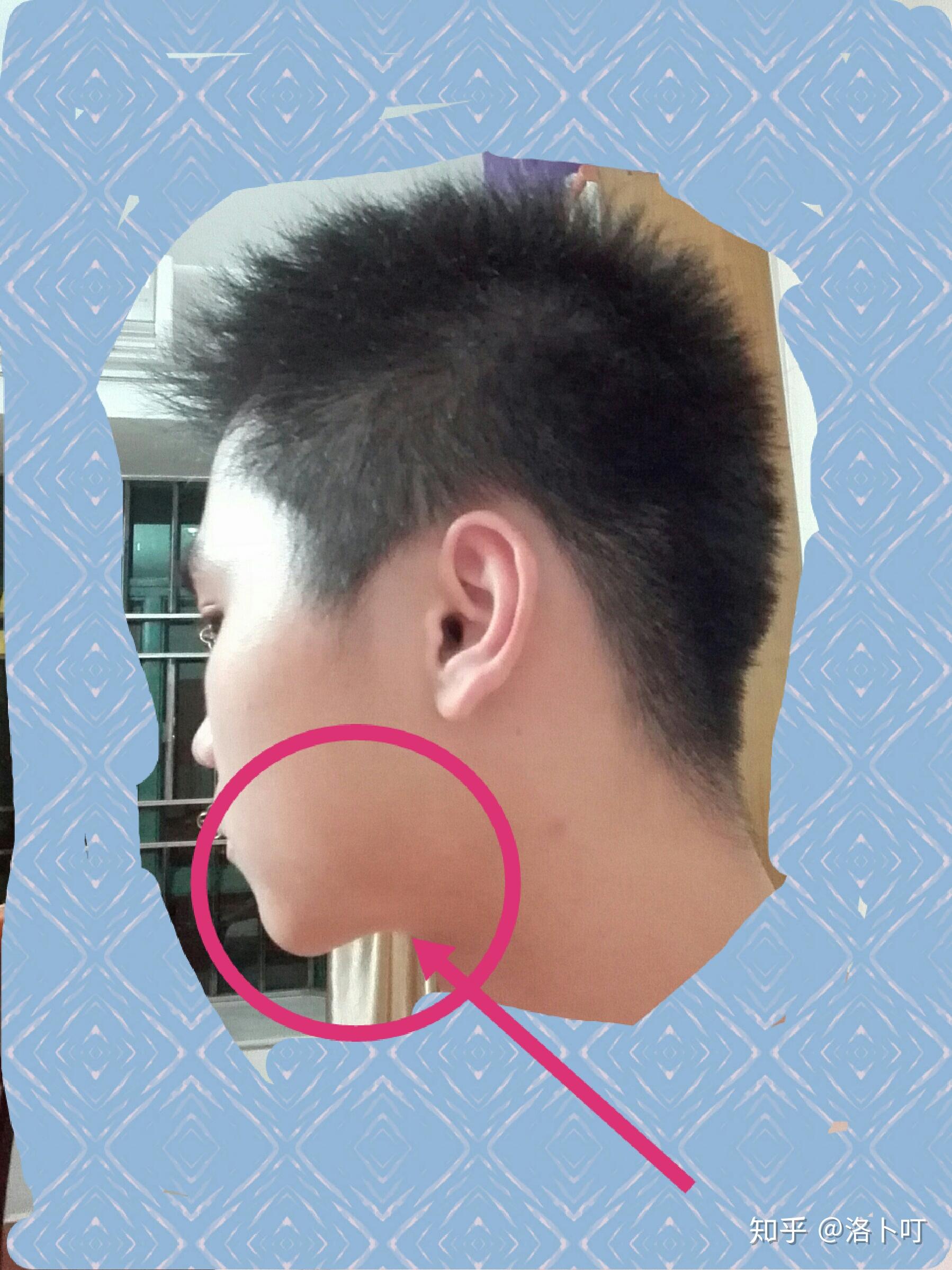 有什么适合下颚角大导致脸型"方正"的男生发型以及穿衣打扮? - 知乎