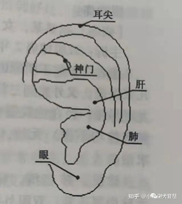 益康耳穴暴發火眼就是我們常說的紅眼病此病如何治療才是關鍵