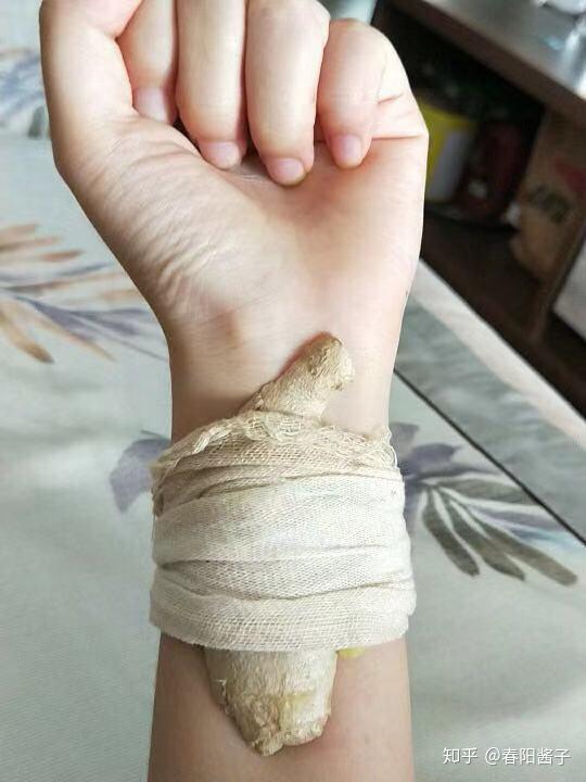 用纱布条或医用胶带绑住姜片固定.