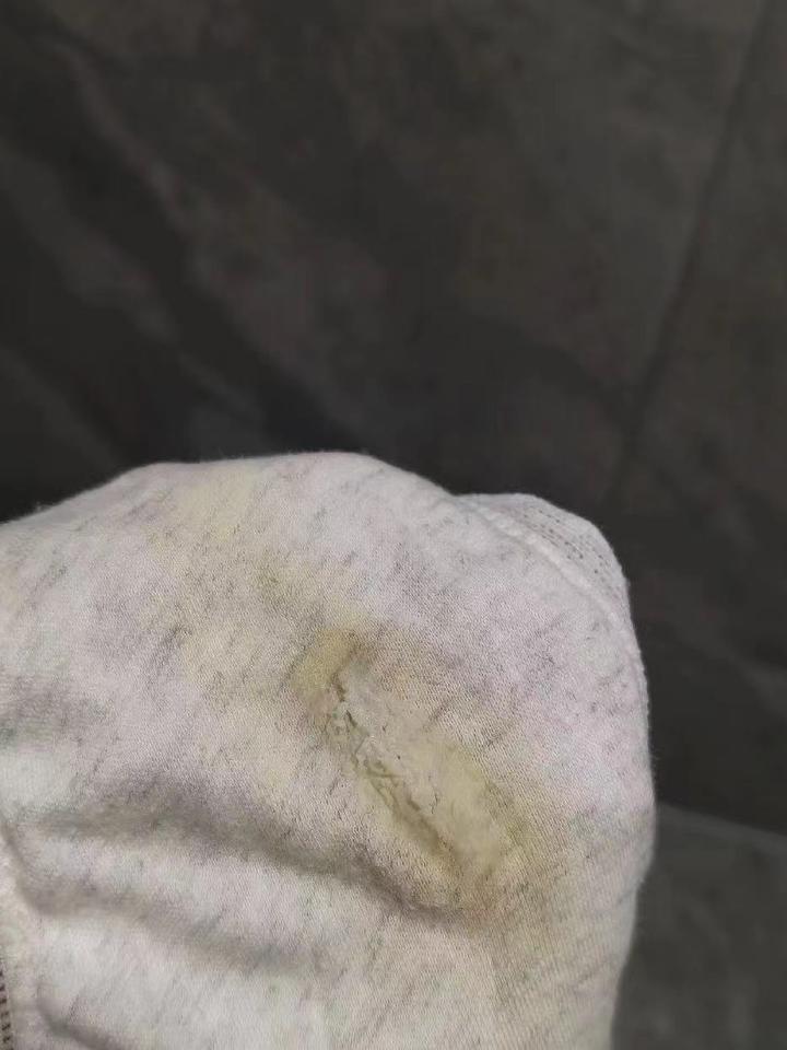 白带出现这3种情况,一定要重视:黄绿分泌物,白带豆腐渣,泡沫分泌物