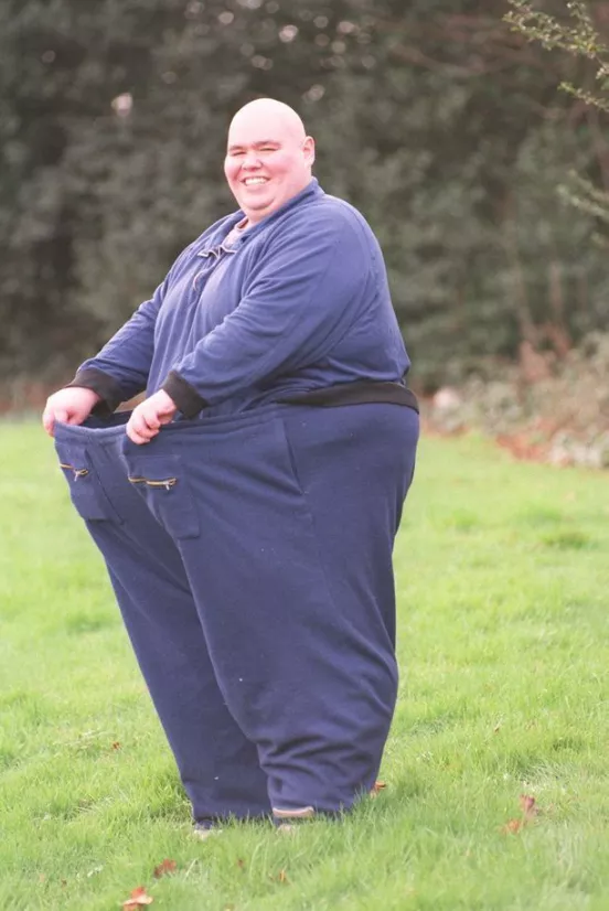 英国前第一胖男离世,每天能吃250碗饭热量,体重最重时超八百斤