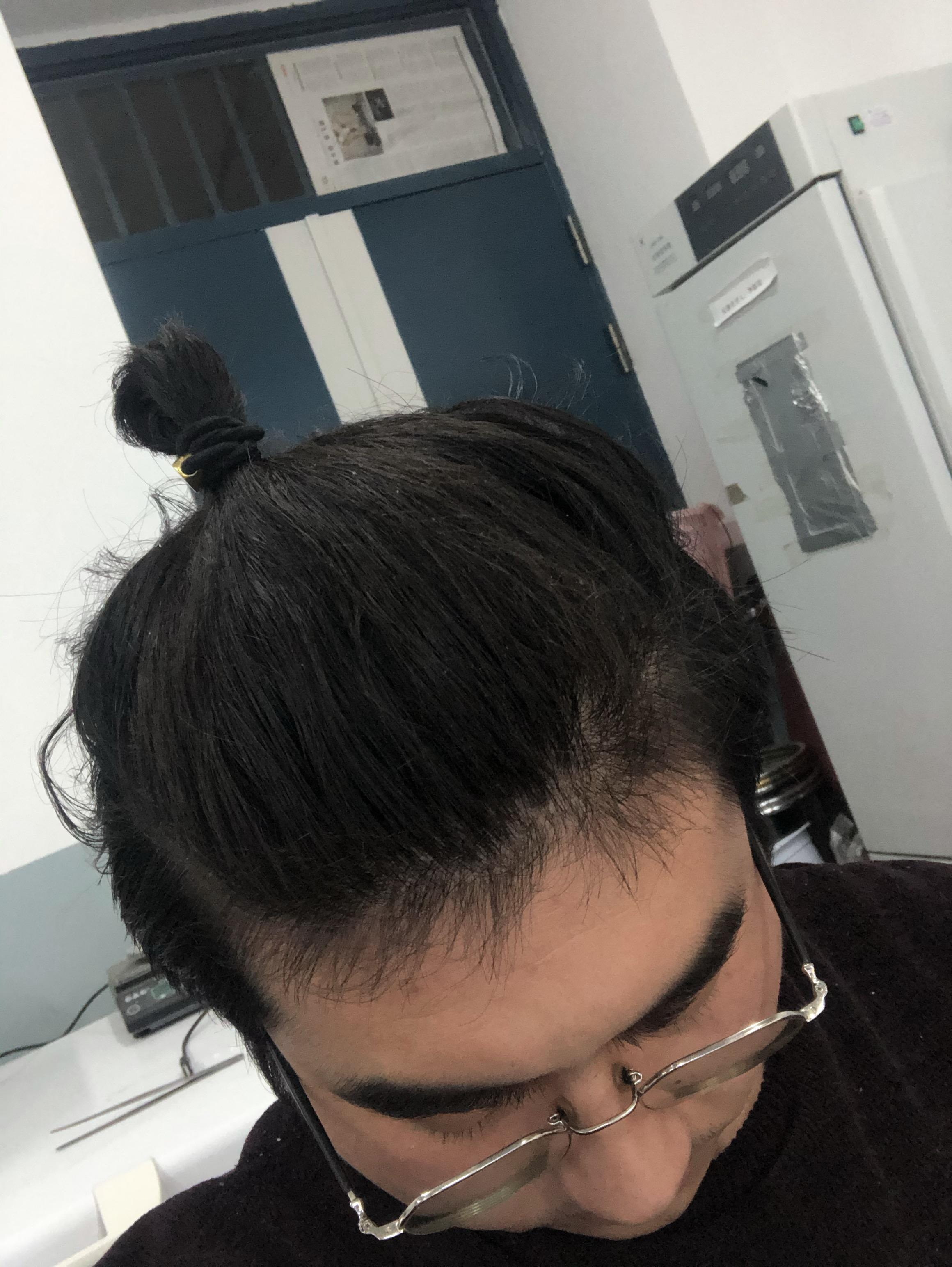 男生蓄发要不要剪后方和左右两侧! - 知乎