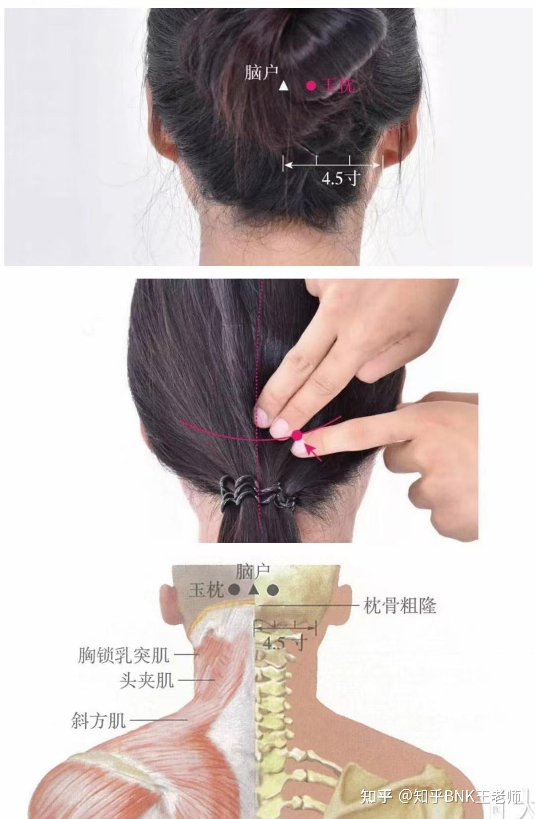 【应知穴位】足太阳膀胱经之玉枕穴 - 知乎