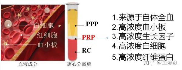 老虎伍兹信赖的PRP疗法，由中国科学家黄宗堂博士升级换代为M-PRP疗法，干细胞再生医学科技领先国际。 - 知乎