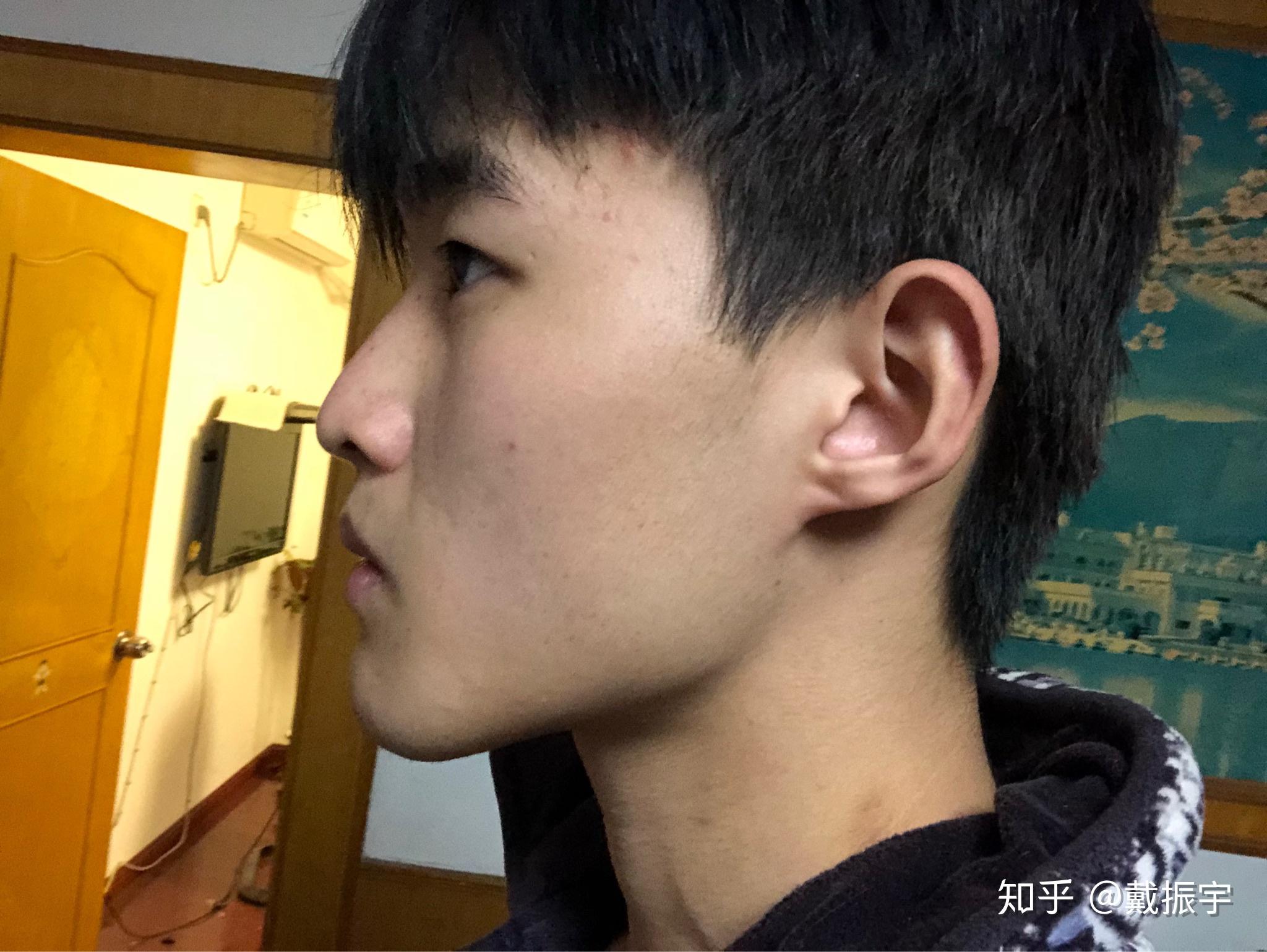 正脸好看但侧脸丑到爆是种怎样的体验?