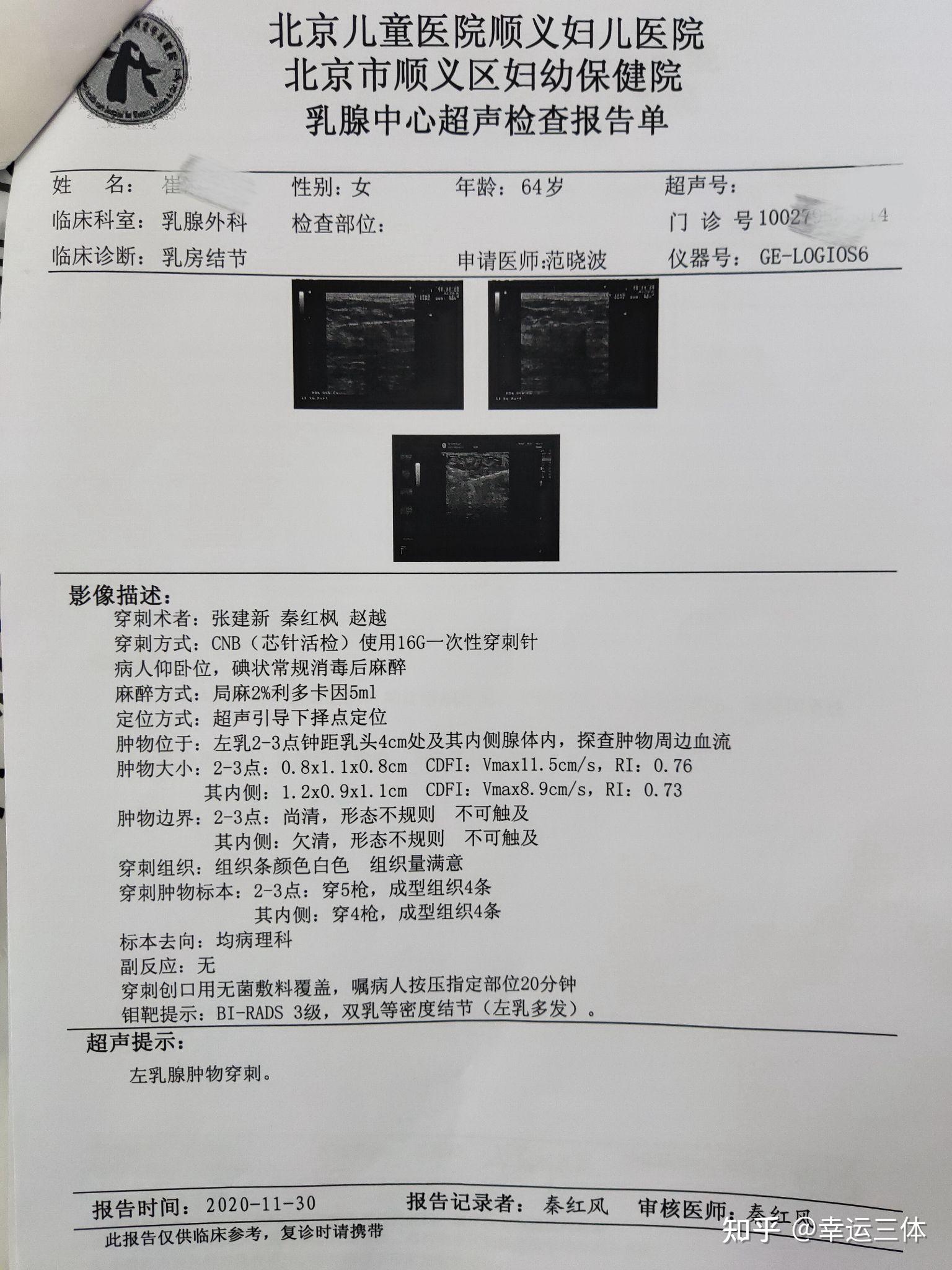 乳腺4c zhuanlan.zhihu.com