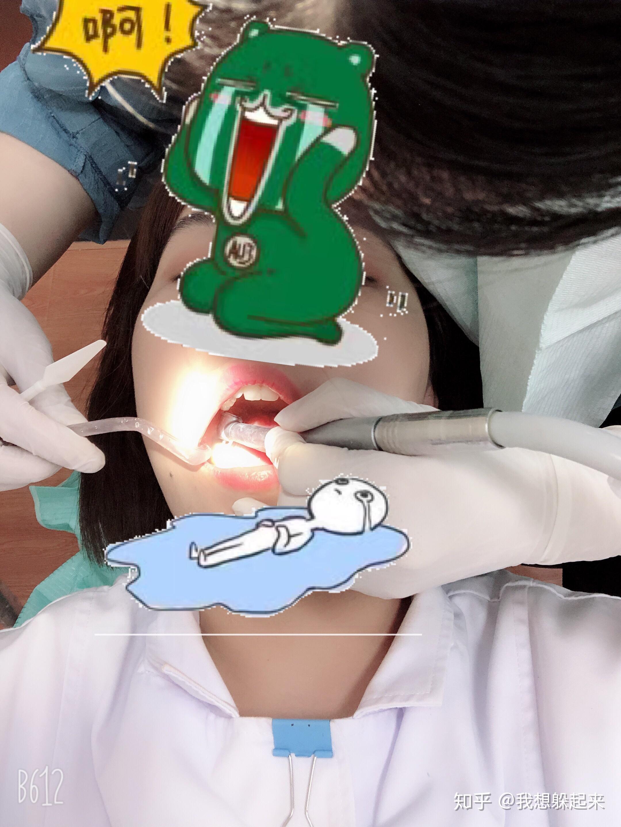 龋齿(蛀牙)非常严重怎么办? - 知乎