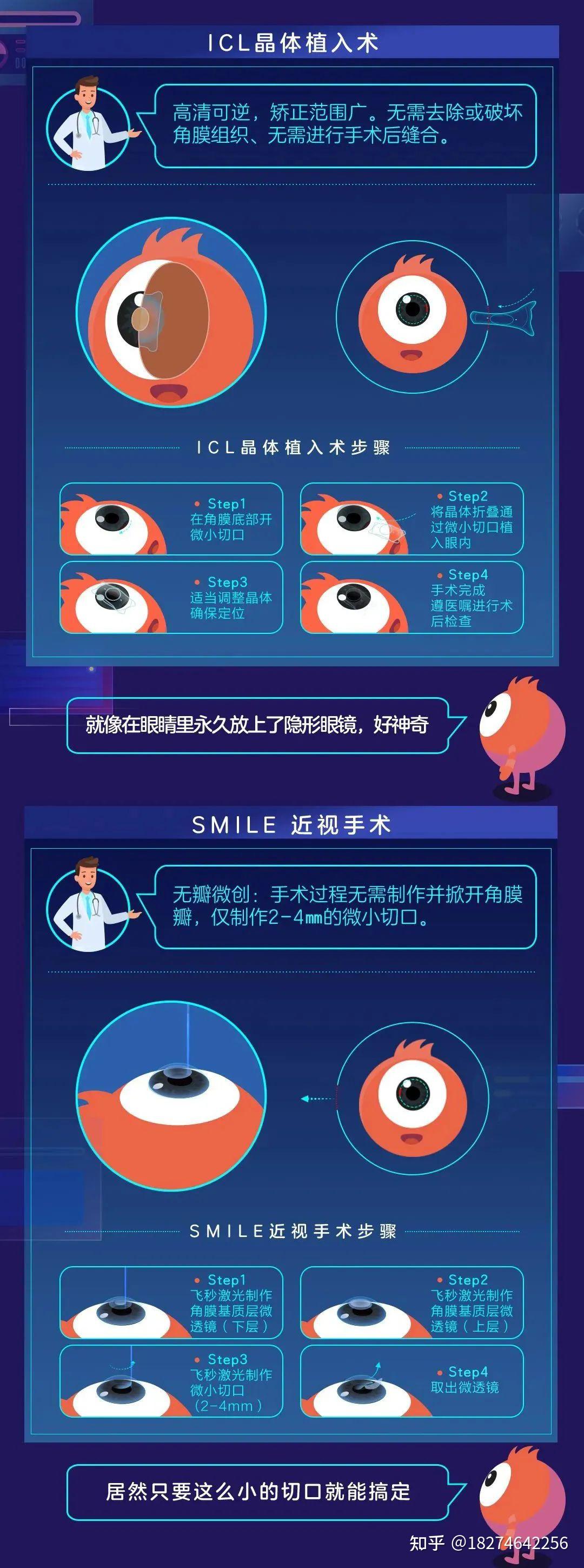 【眼健康科普课堂】可怕！做了近视手术，老了以后会...瞎？ - 知乎
