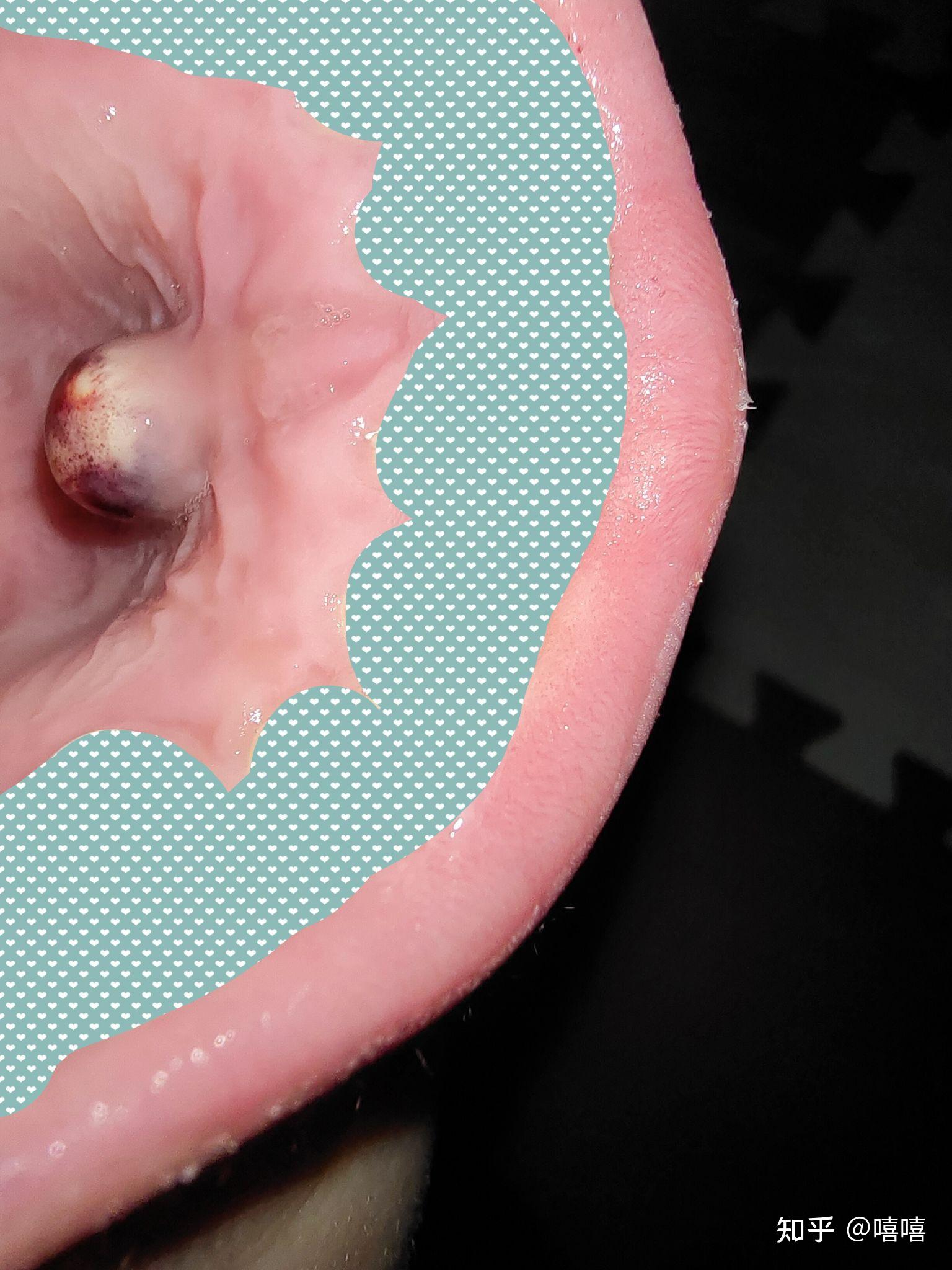 口腔上颚涨了个包,医生检查后说有可能是囊肿,说拍