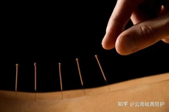 50种病证针灸最常用穴位统计 - 知乎