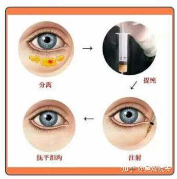 v2-f41a4d603c9ef6a5773bab2af3f66870_b.jpg