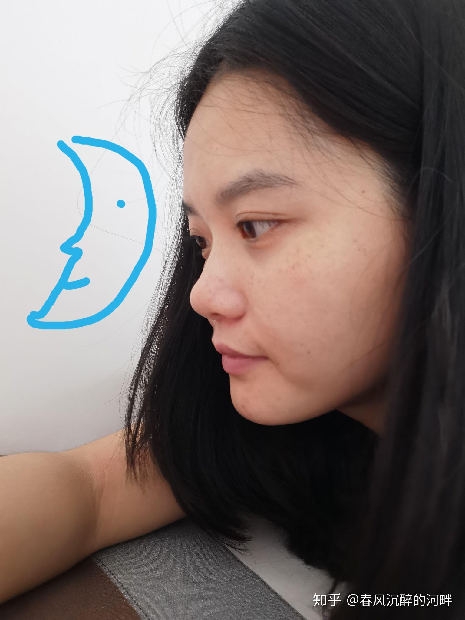 侧脸不好看怎么办?是哪里不协调或者是哪里有缺陷?