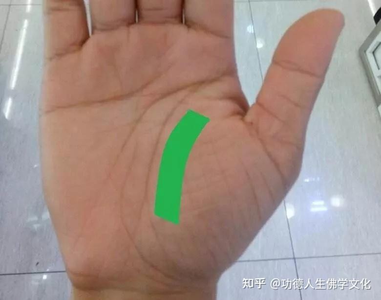 手是健康的镜子,10种常见病,从手上就能看出来! - 知乎