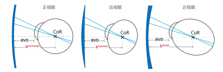 眼镜佩戴不舒适、视野小、周边模糊的原因分析——泽锐- 知乎