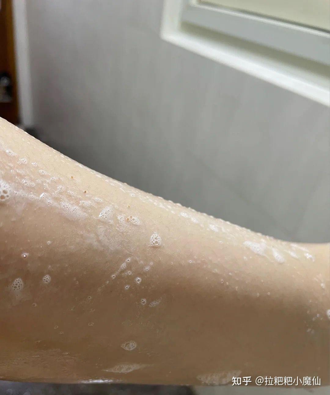 美女有鸡皮肤吗知乎小说(美女有鸡皮肤吗知乎小说免费阅读)