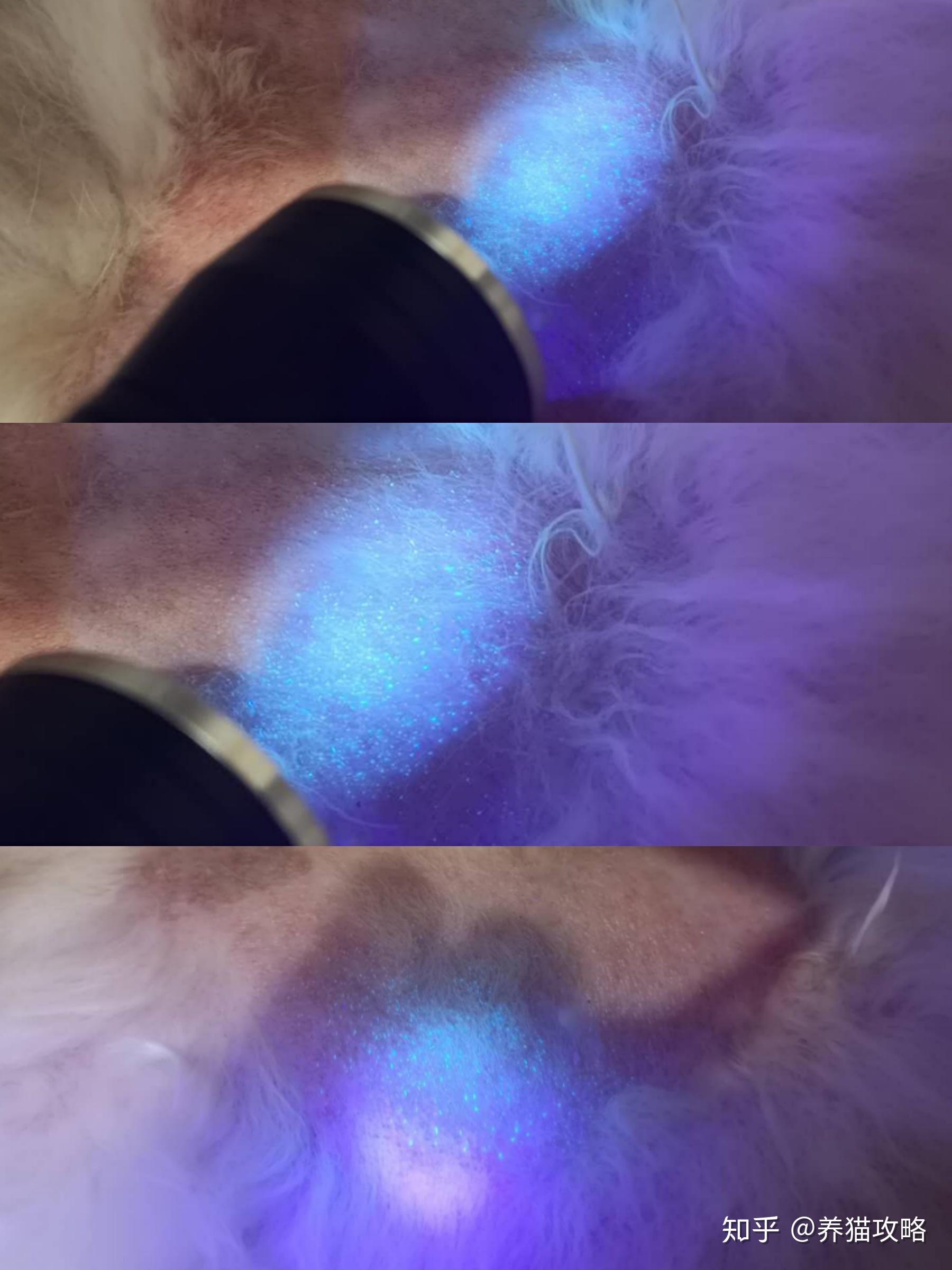 伍德氏灯照的情况,真菌孢子一天比一天少但这三种药加起来,也只要