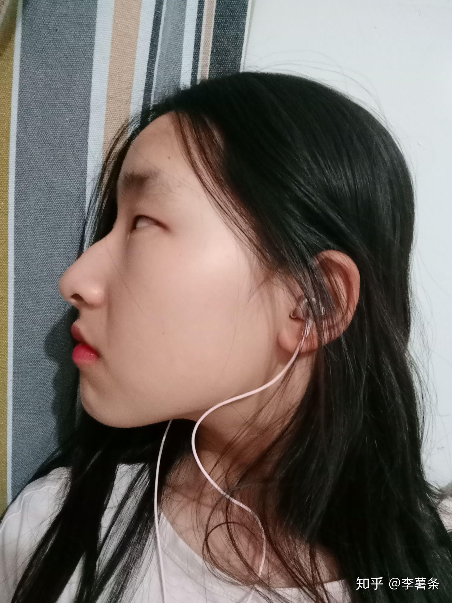 正脸正常,侧脸丑到爆是什么体验?