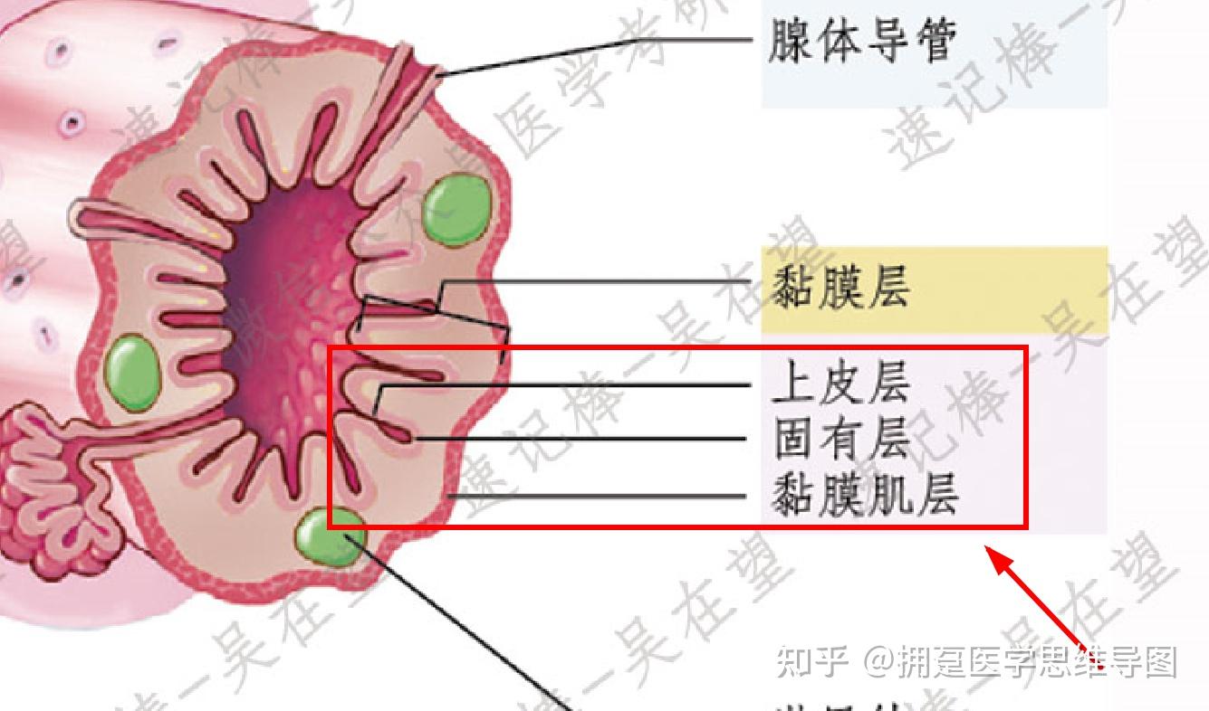 而原位癌是位于上皮层没有突破基底膜的癌肿瘤位于黏膜层或黏膜下层都