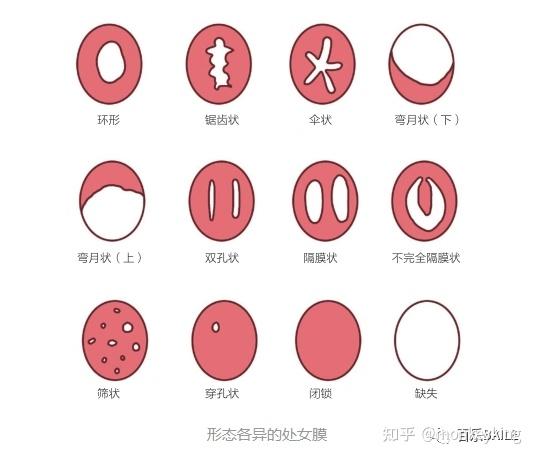 女人破膜后高清图图片