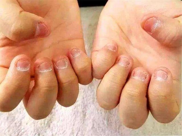 小朋友爱咬手指头是什么原因? - 知乎