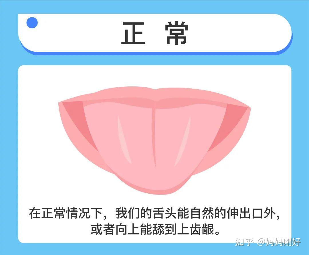 “舌根没剪，说话不利索”，别用你的无知害惨了孩子！ - 知乎