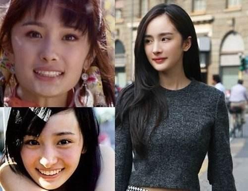娱乐圈关于整容的那些事 - 知乎