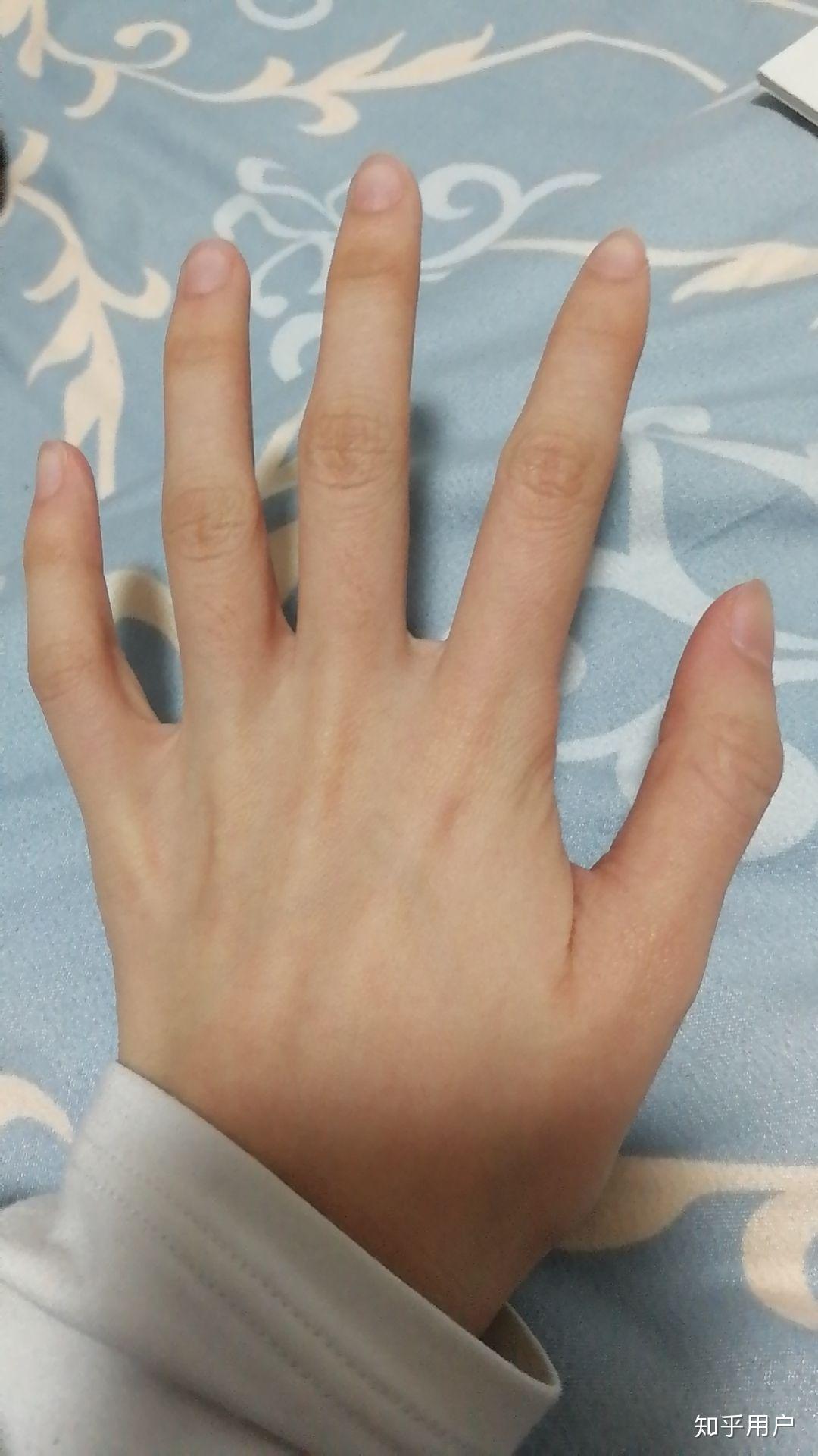 女生如何才能有个骨节分明的手? - 知乎