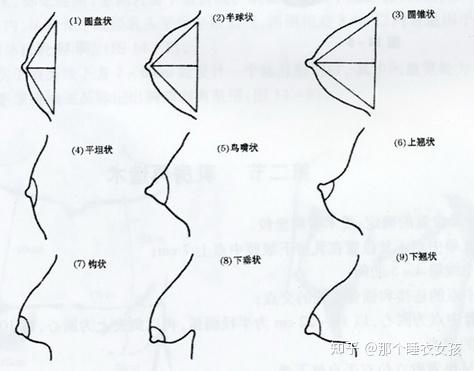 圆盘形胸适合什么内衣?