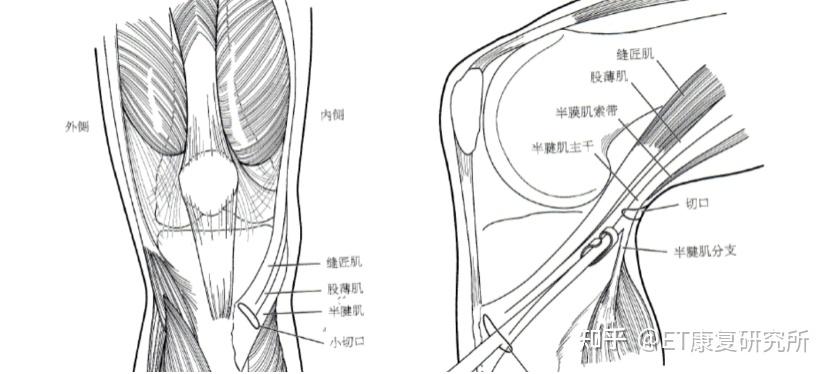 术后康复