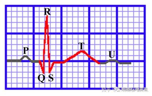 心电图各波,段的命名和定义,你掌握了吗?