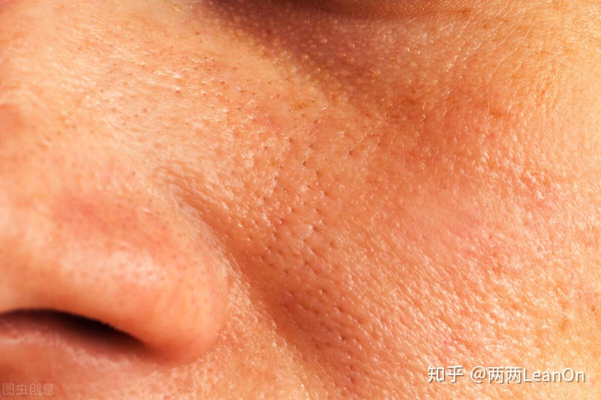 皮肤毛孔堵塞怎么办？怎么改善？ | 说明书网