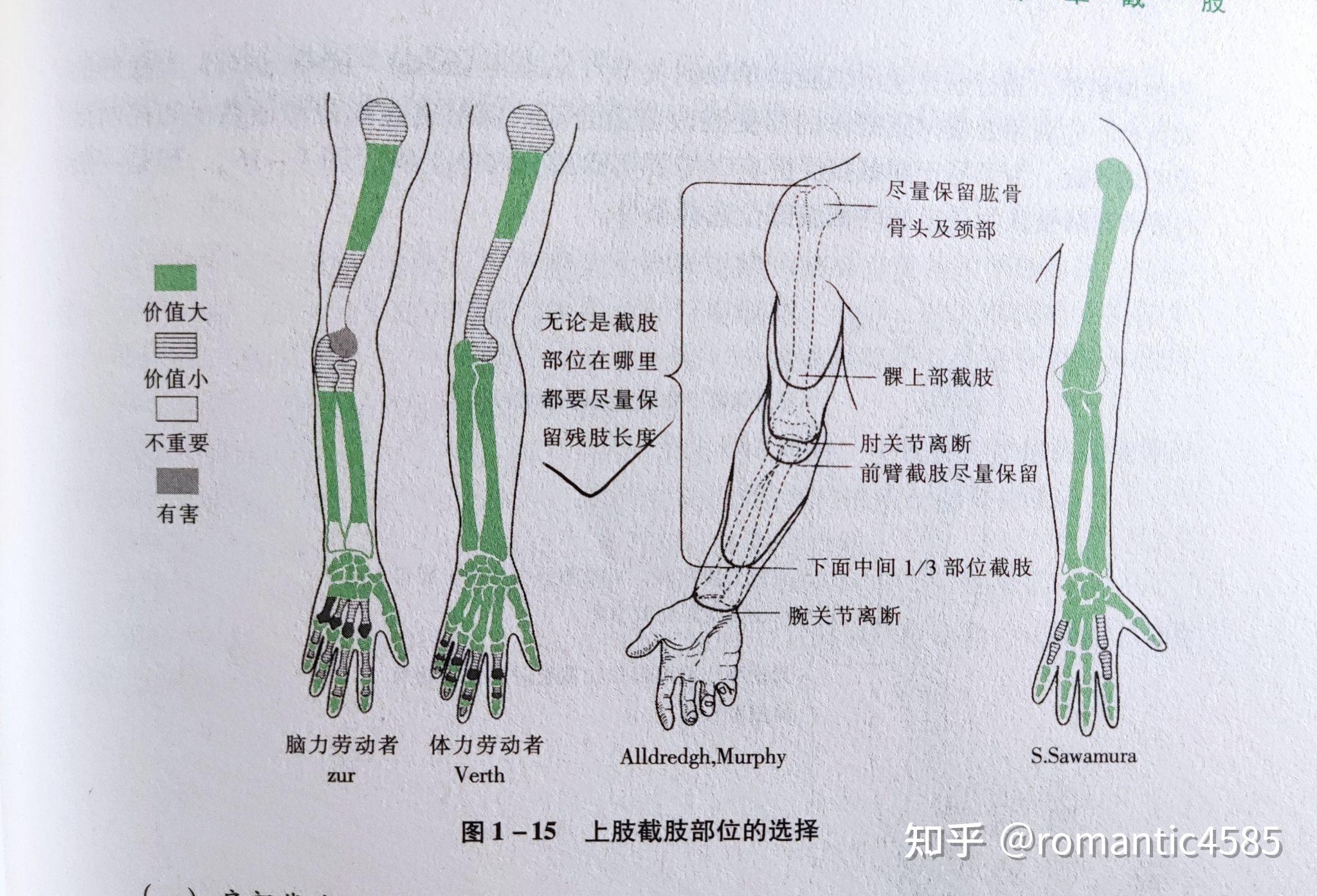 手臂分为几个部分图片