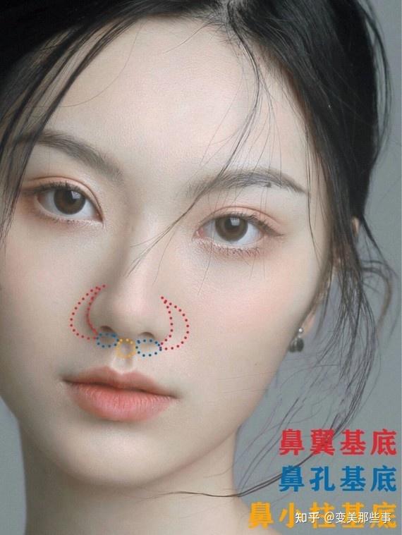 鼻基底凹陷真的是颜值硬伤吗?