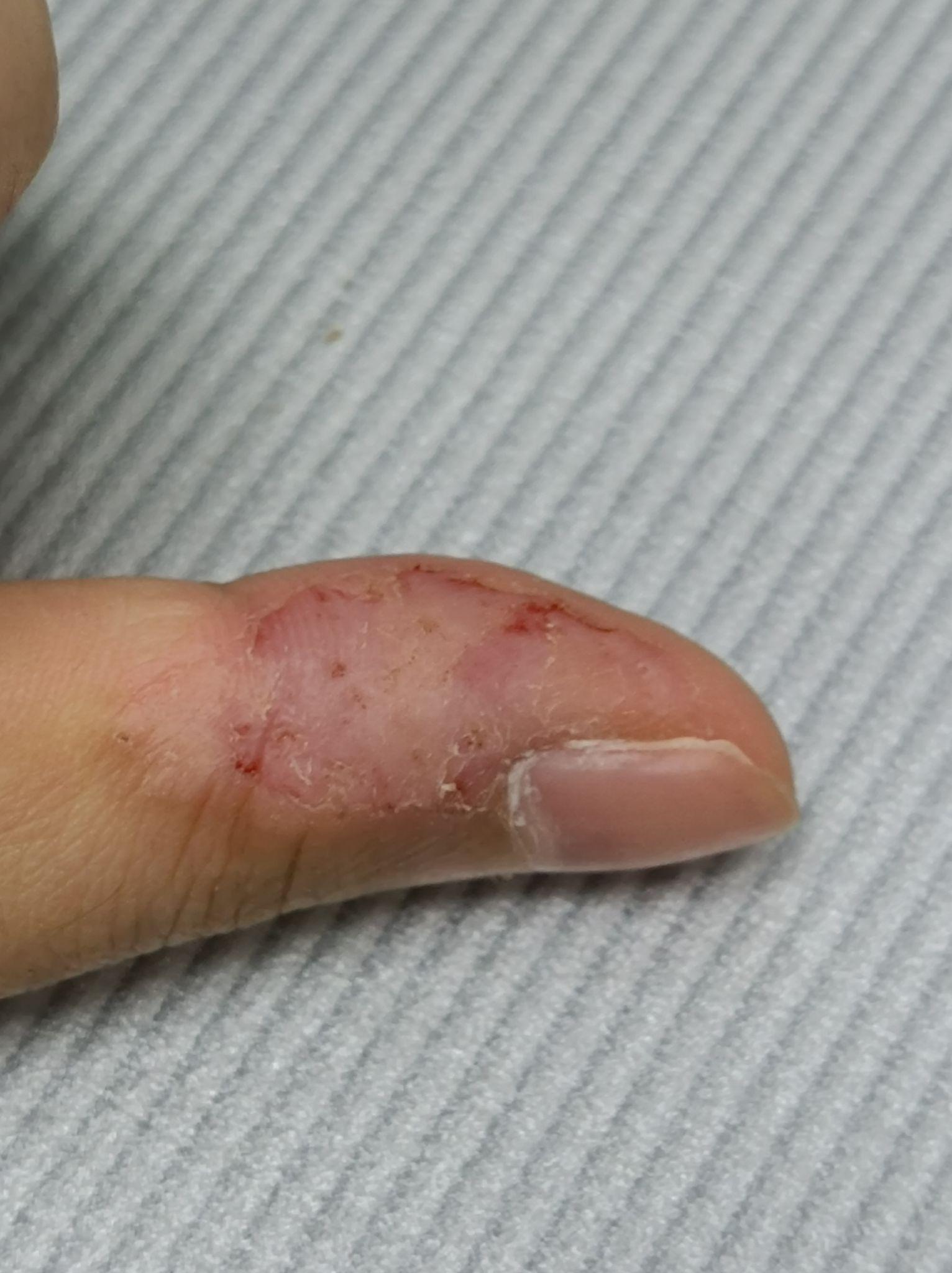 有喜欢抠指甲旁边的皮的吗? - 知乎